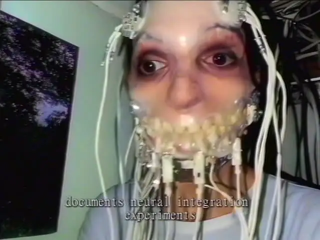 A wired recipient with exposed dental hardware in Internal Archive file 006.